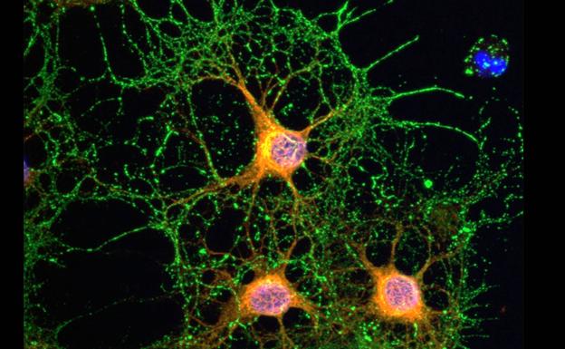 Imagen de una neurona./Universidad de Castilla-La Mancha (UCLM)