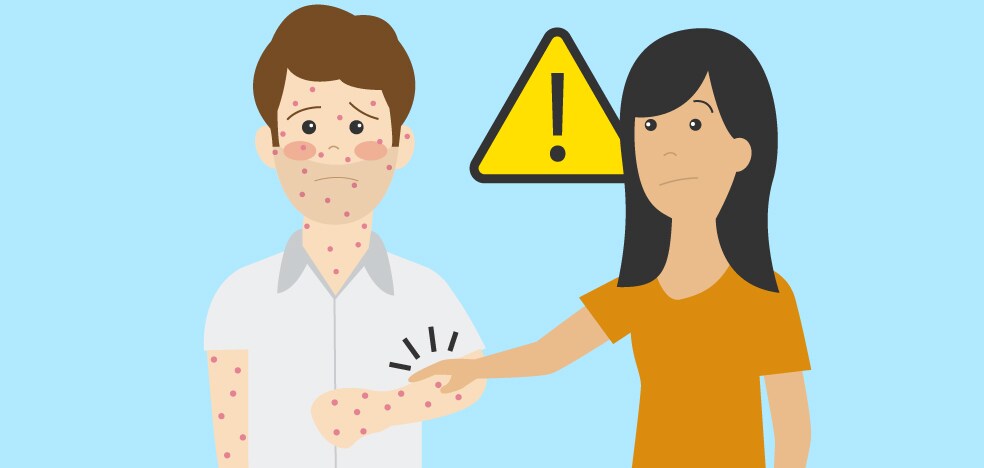 Visual guide to monkeypox: what it is and how it spreads