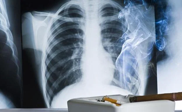 Lung cancer is one of the most frequent and aggressive. 